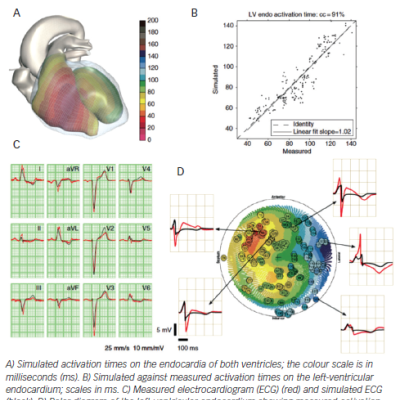 Figure 3 Comparison of Measured and Simulated Data in One Patient