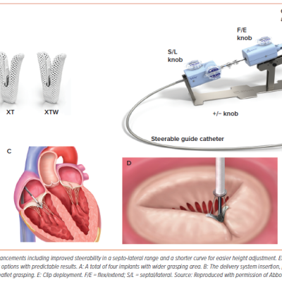 Figure 3 TriClip G4 Transcatheter Tricuspid Valve Repair System