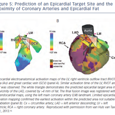 Figure 5 Prediction of an Epicardial Target Site and the Proximity of Coronary Arteries and Epicardial Fat