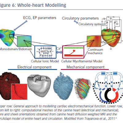 Figure 6 Whole-heart Modelling