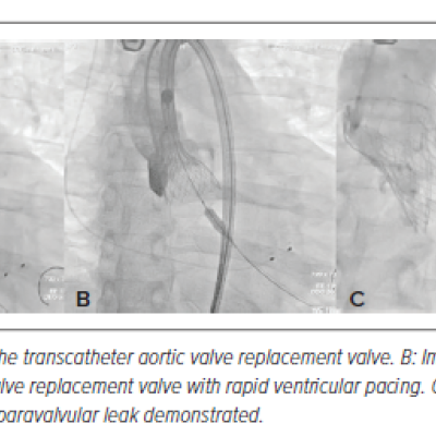 Figure 2 Intraoperative Fluoroscopic Images