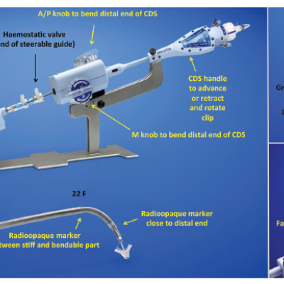 Figure 2 MitraClip® Delivery System and Guiding Catheter and Characteristics of the Clip