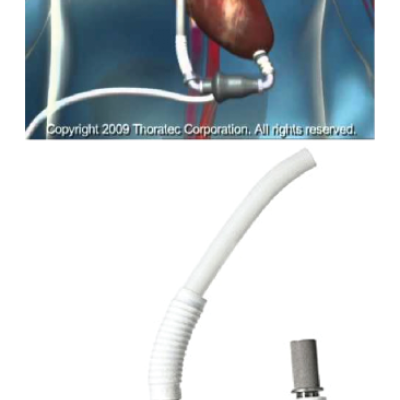 Figure 3 HeartMate II