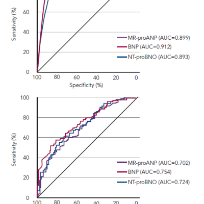 Figure 3 Receiver-Operator Curves for NT-proBNP MR-proANP and BNP in Discriminating AHF Among Patients with Acute Breathlessness With and Without Atrial Fibrillation