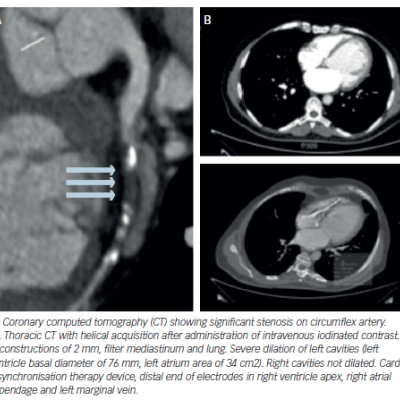 Figure 5 Contrast-enhanced Multidetector Computed Tomography Image