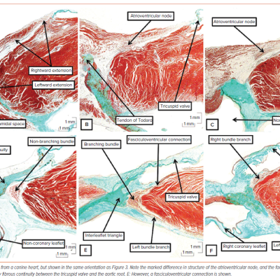 Figure 7 Conduction Axis in the Canine Heart