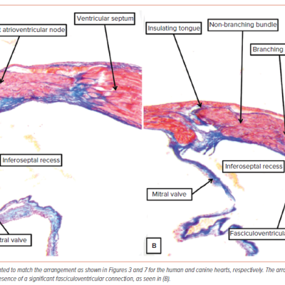 Figure 8 Conduction Axis in an Adult Mouse Heart