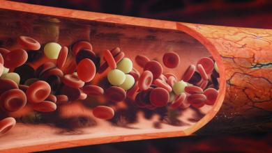 Anticoagulant Therapy for Acute Coronary Syndromes