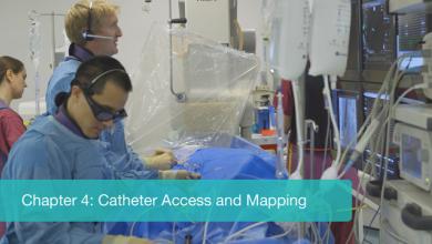 Efficient AF Ablation Workflow With Carto®3 System and Ablation Index