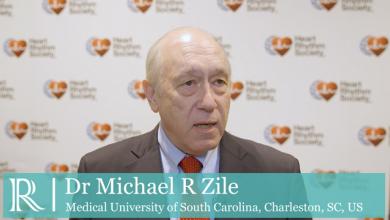 HRS 2019: Baroreflex Activation Therapy (BAT) for HFrE