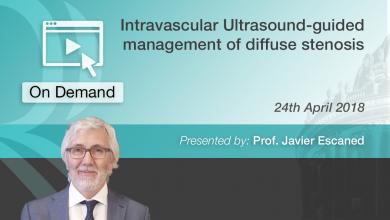 RC Webinars: Intravascular ultrasound guided management of diffuse stenosis