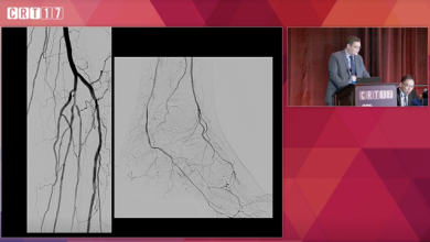 Techniques For Alternative Access In Endovascular Intervention - Ehrin Armstrong