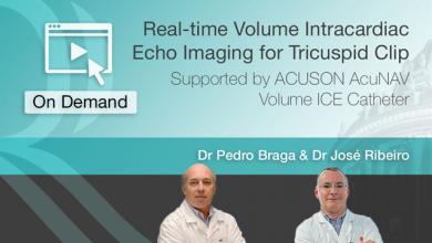 Real-time volume intracardiac echo imaging for Tricuspid clip