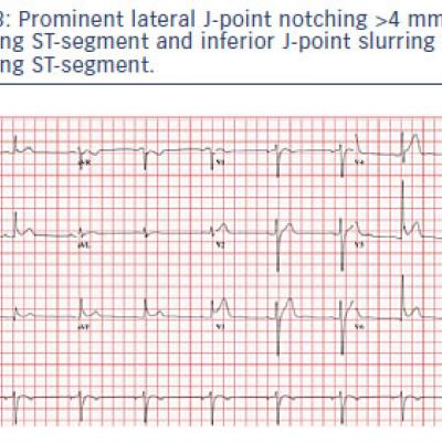 Image Gallery | Radcliffe Cardiology